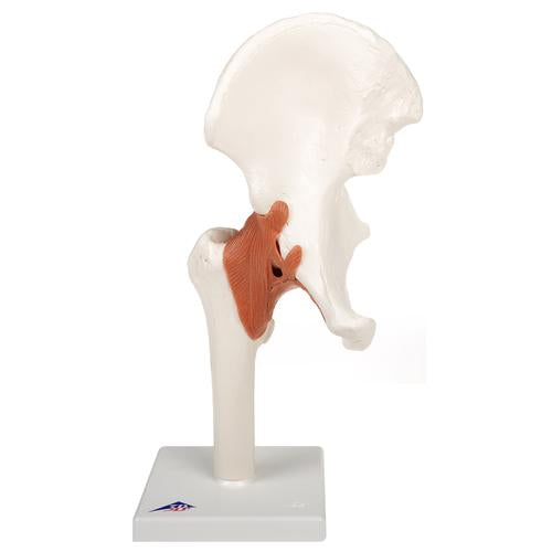 Modèle fonctionnel de luxe de l'articulation de la hanche - Anatomie et pathologie